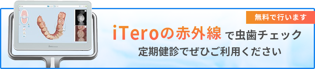 iTero