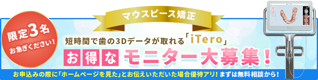 iTero