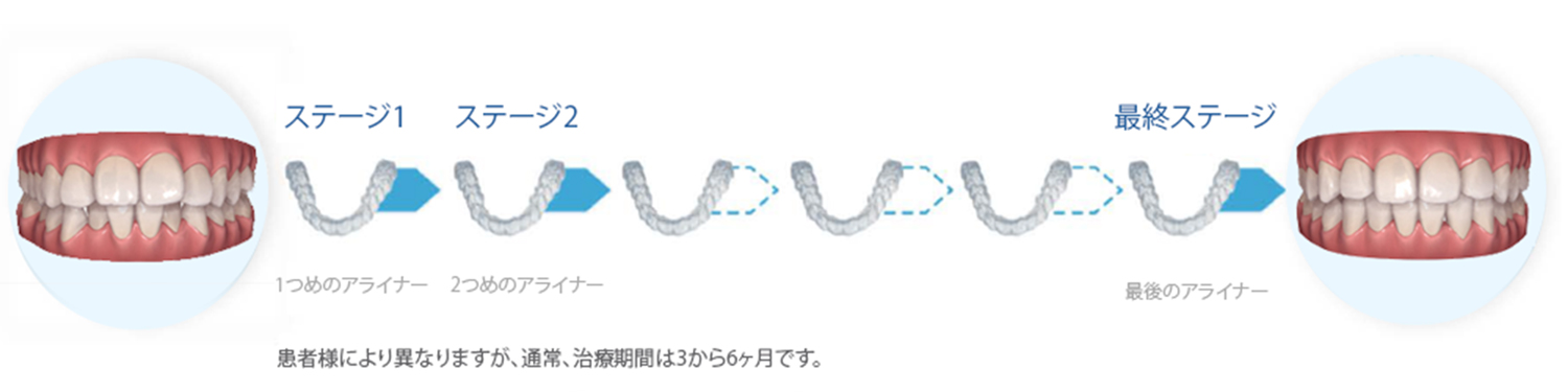 イメージ画像