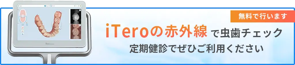 iTero